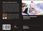 Résines composites indirectes