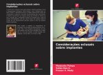 Consideraç?es oclusais sobre implantes