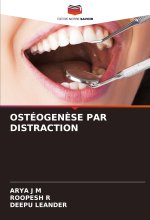 OSTÉOGEN?SE PAR DISTRACTION
