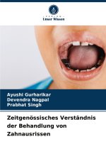 Zeitgenössisches Verständnis der Behandlung von Zahnausrissen
