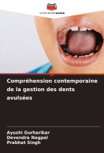 Compréhension contemporaine de la gestion des dents avulsées