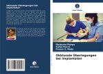 Okklusale Überlegungen bei Implantaten