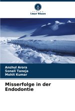 Misserfolge in der Endodontie
