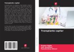 Transplante capilar