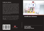 Greffe de cheveux