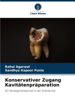 Konservativer Zugang Kavitätenpräparation
