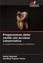 Preparazione della cavit? con accesso conservativo