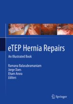 eTEP Hernia Repairs