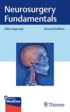 Neurosurgery Fundamentals 2e