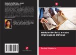Nódulo linfático e suas implicaç?es clínicas