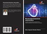 Rivascolarizzazione miocardica