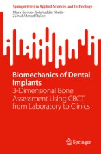 Biomechanics of Dental Implants
