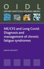 Chronic Fatigue