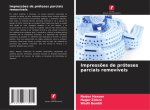Impress?es de próteses parciais removíveis