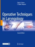 Operative Techniques in Laryngology