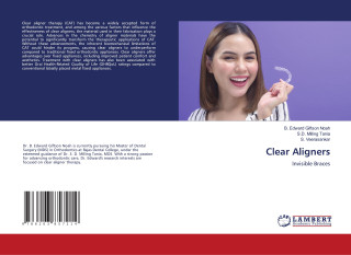 Clear Aligners