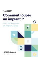 COMMENT LOUPER IMPLANT
