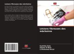 Lésions fibreuses des mâchoires