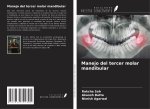 Manejo del tercer molar mandibular
