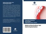 Abdrucktechniken bei Zahnimplantaten