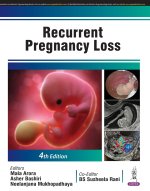 Recurrent Pregnancy Loss