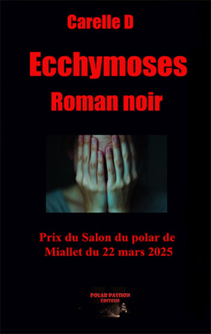 Ecchymoses