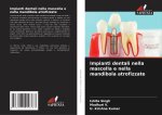 Impianti dentali nella mascella e nella mandibola atrofizzate