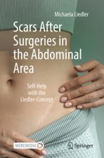 Scars After Surgeries in the Abdominal Area