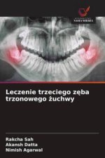 Leczenie trzeciego zeba trzonowego zuchwy