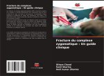 Fracture du complexe zygomatique : Un guide clinique
