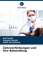Zahnverfärbungen und ihre Behandlung