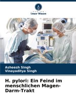 H. pylori: Ein Feind im menschlichen Magen-Darm-Trakt