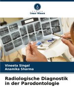 Radiologische Diagnostik in der Parodontologie