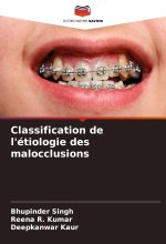 Classification de l'étiologie des malocclusions
