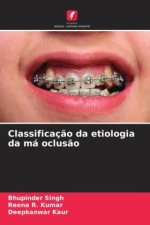Classificaç?o da etiologia da má oclus?o