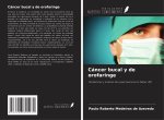 Cáncer bucal y de orofaringe