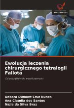 Ewolucja leczenia chirurgicznego tetralogii Fallota