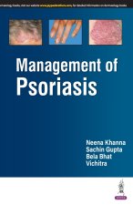 Management of Psoriasis