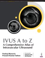 IVUS A to Z