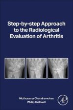 RADIOLOGICAL EVAL OF ARTHRITIS
