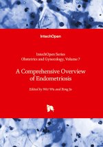 A Comprehensive Overview of Endometriosis