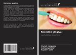 Recesión gingival
