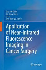 Application of Near-Infrared Fluorescence Imaging in Cancer Surgery