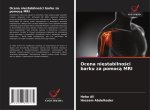 Ocena niestabilnosci barku za pomoca MRI