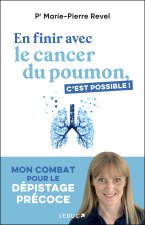 En finir avec le cancer du poumon