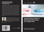 Implantología Dental y Reconstrucción Ósea en Cirugía Oral