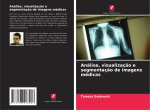 Análise, visualizaç?o e segmentaç?o de imagens médicas