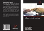 Rekonstrukcja ?uchwy