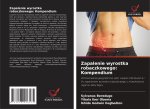 Zapalenie wyrostka robaczkowego: Kompendium