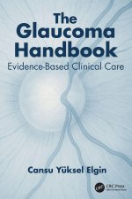 Glaucoma Handbook